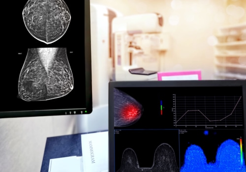 Finding Peace: NYC's Fibroids Specialists And The Importance Of Respite Care